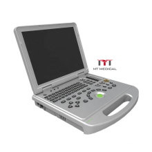 Laptop medical ultrasound instruments 3D/4D  Color Doppler 128 elements ultrasound machine